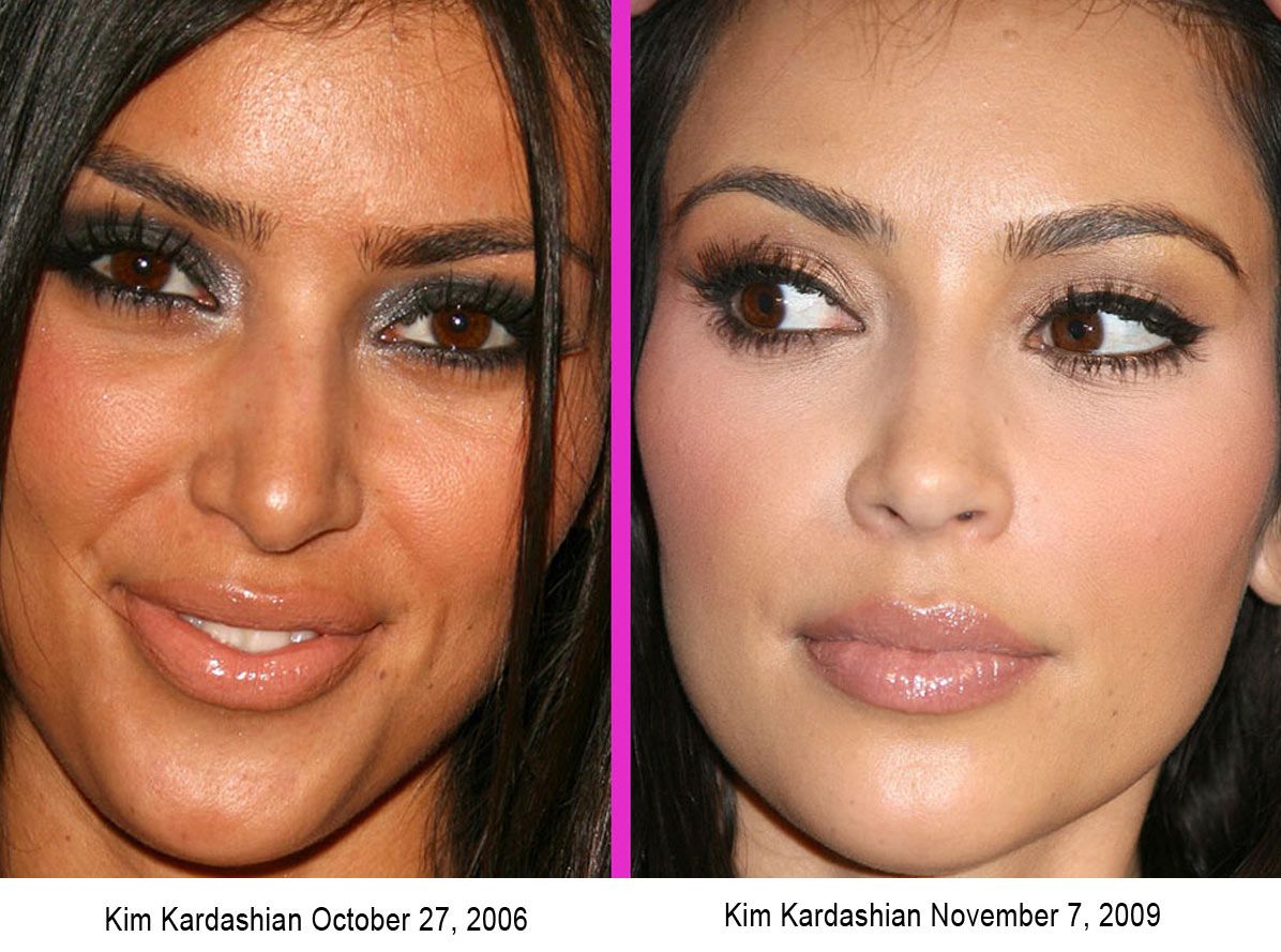 http://starcasm.net/wp-content/uploads/2009/11/KimKardashianBeforeandafter.jpg